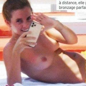 Delphine EMMA WATSON TOPLESS NUDE SUNBATHING PHOTOS PUBLISHED IN FRANCE - France on dochick.com